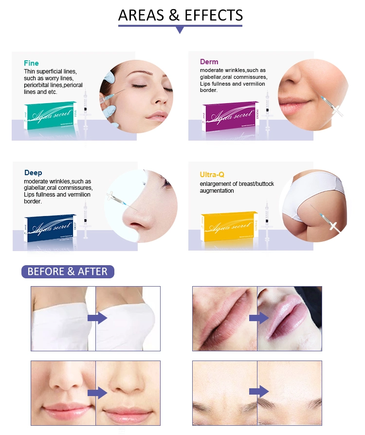 Hyaluronic Acid Liquid Collagen Fillers Buttock Injection