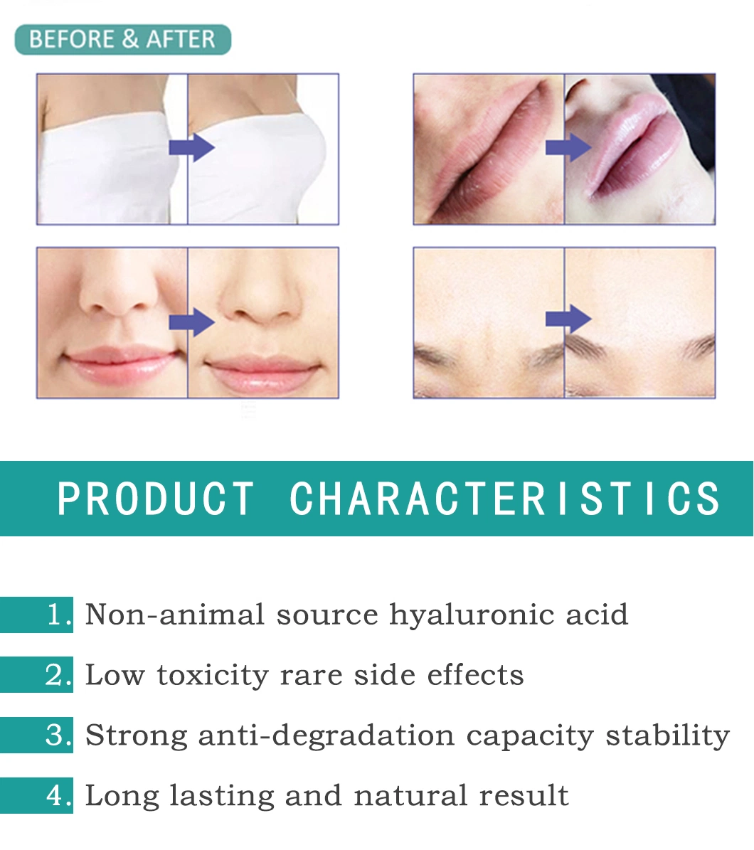 10ml Syringe Hyaluronic Acid Liquid Filler Butt Injections